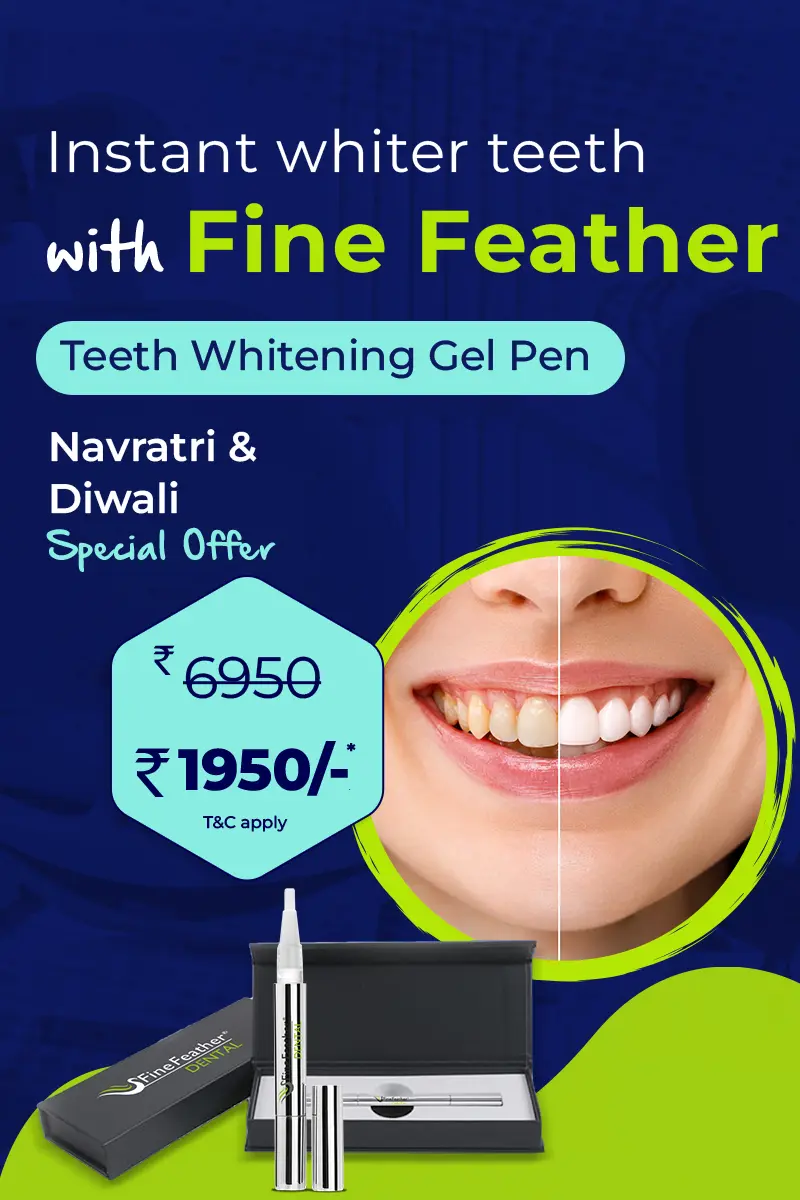 finefeather 13 mobile