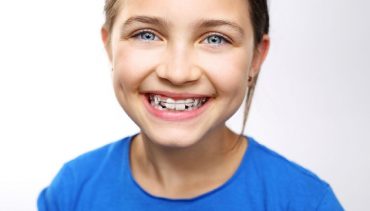 INTERCEPTIVE ORTHODONTICS