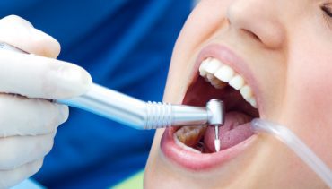 How does a Root Canal treatment save your tooth?