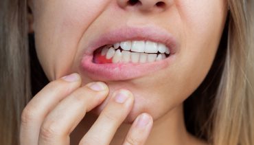 Can Gum Diseases Be Cured?