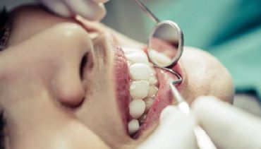 Is Scaling Good for Our Gums and Teeth?