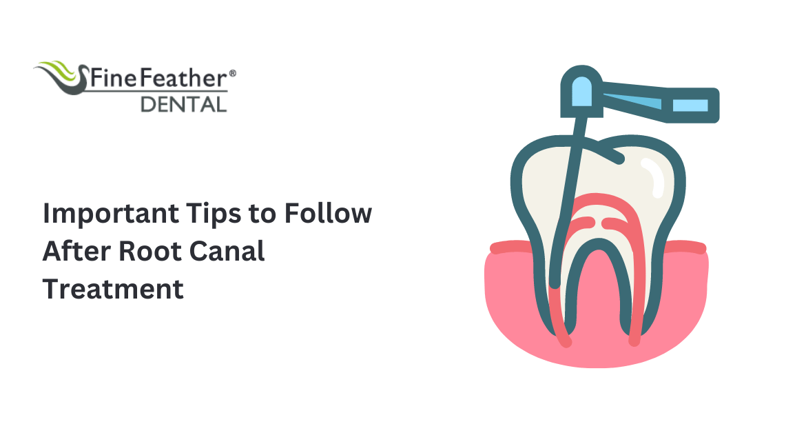 Important Tips to Follow After a Root Canal Treatment