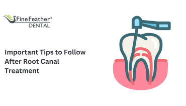 Important Tips to Follow After a Root Canal Treatment