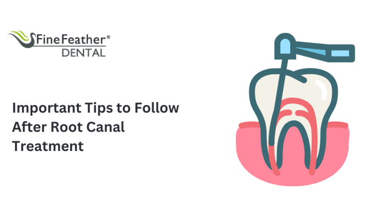 Important Tips to Follow After a Root Canal Treatment