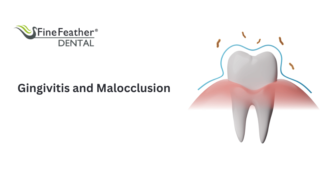 Gingivitis and Malocclusion