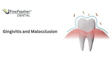 Gingivitis and Malocclusion