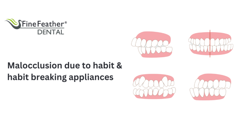 Malocclusion Due to Habit and Habit Breaking Appliances