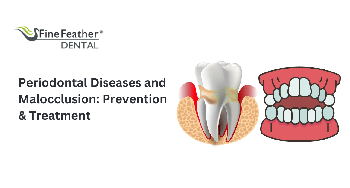 Periodontal Diseases and Malocclusion: Prevention and Treatment
