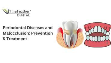 Periodontal Diseases and Malocclusion: Prevention and Treatment