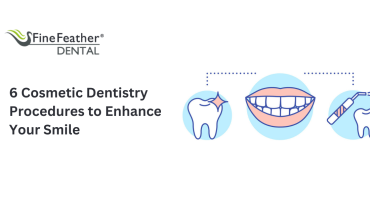 6 Cosmetic Dentistry Procedures to Enhance Your Smile