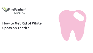 How to Get Rid of White Spots on Teeth?