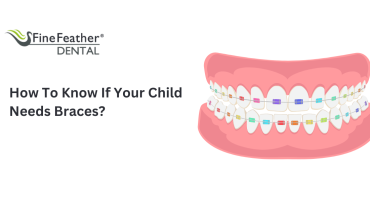 How To Know If Your Child Needs Braces?