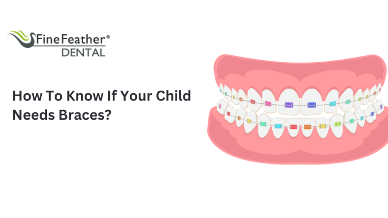 How To Know If Your Child Needs Braces?