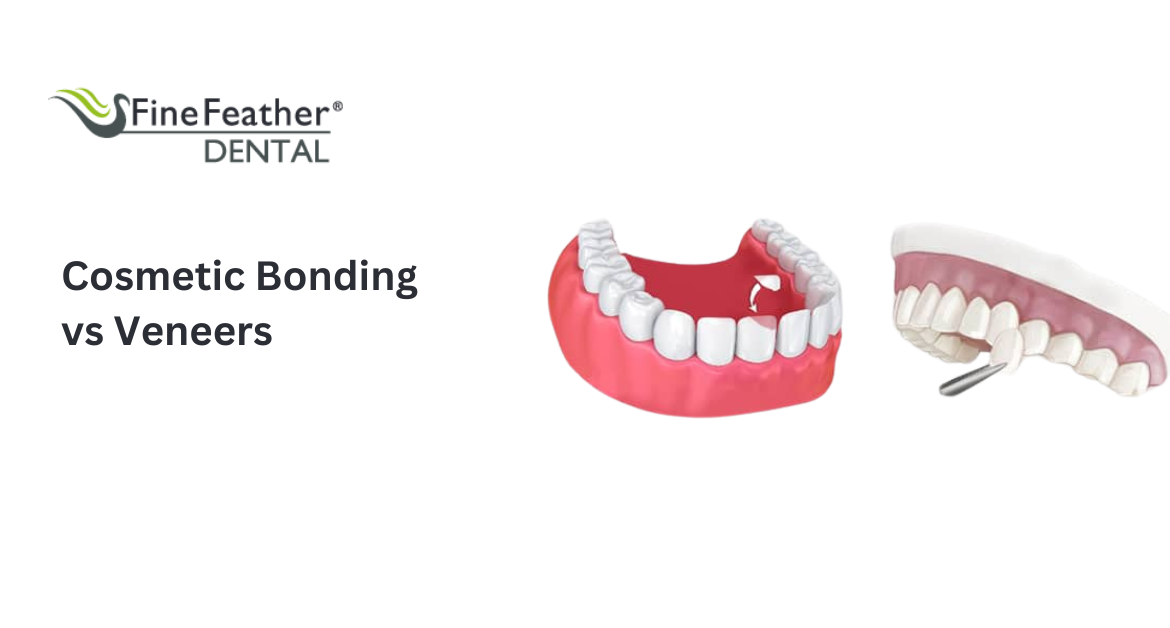 Cosmetic Bonding vs Veneers: Which Is Right for Your Perfect Smile?