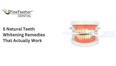 5 Natural Teeth Whitening Remedies That Actually Work